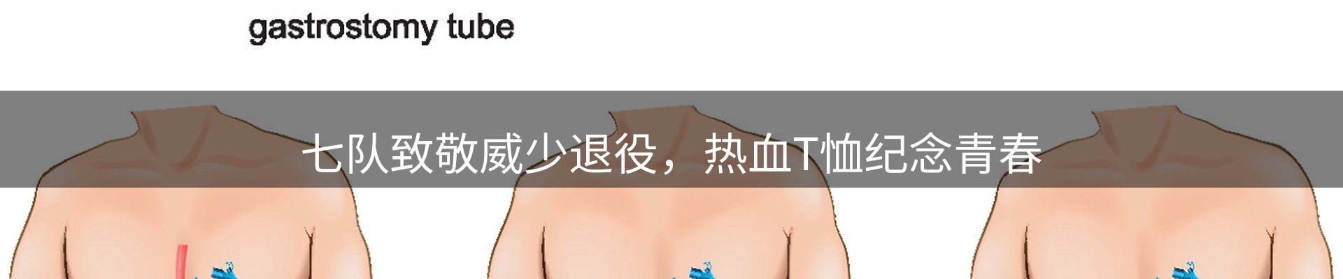 热点聚焦